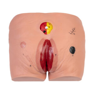 Model pośladków z odparzeniami