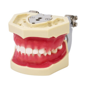 Model patologii dziąseł