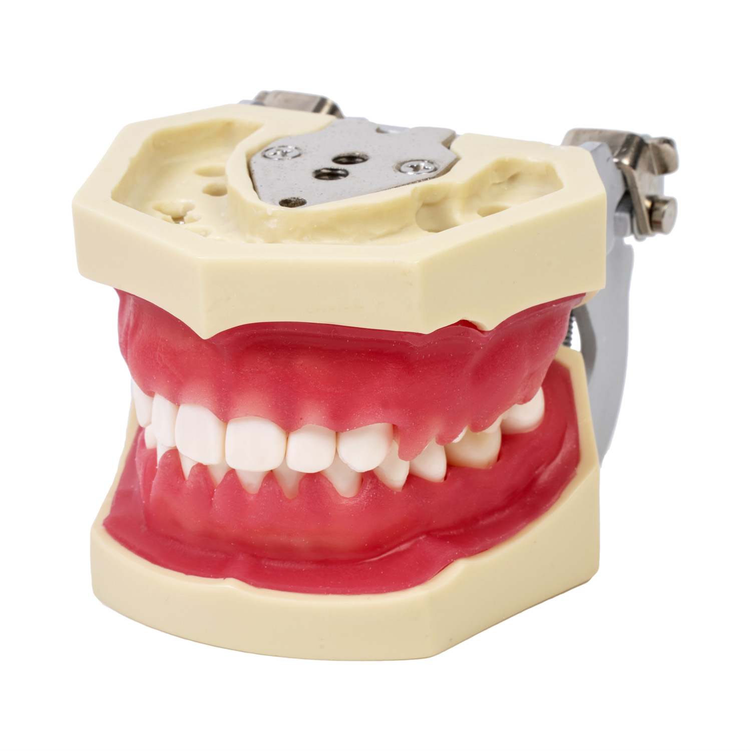 Model patologii dziąseł