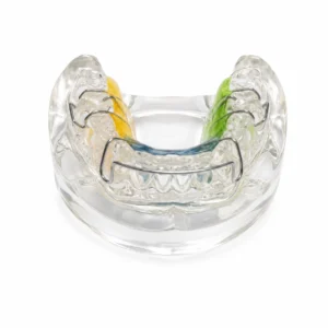 Klarer Dentalretainer mit farbigen Abschnitten (gelb, blau, grün) auf weißem Hintergrund; eine kieferorthopädische Vorrichtung zur Zahnkorrektur.