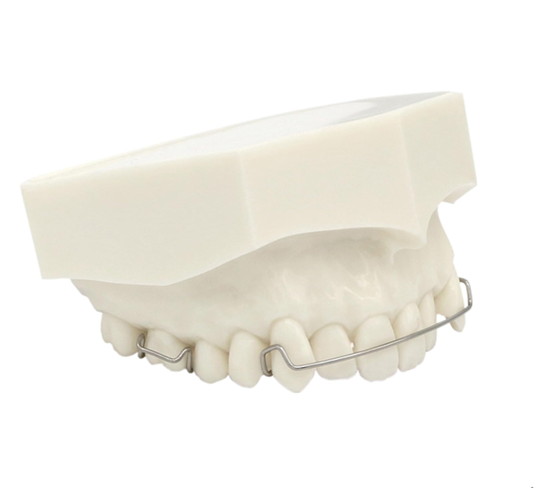 Model dentystyczny górnej szczęki z retainerem