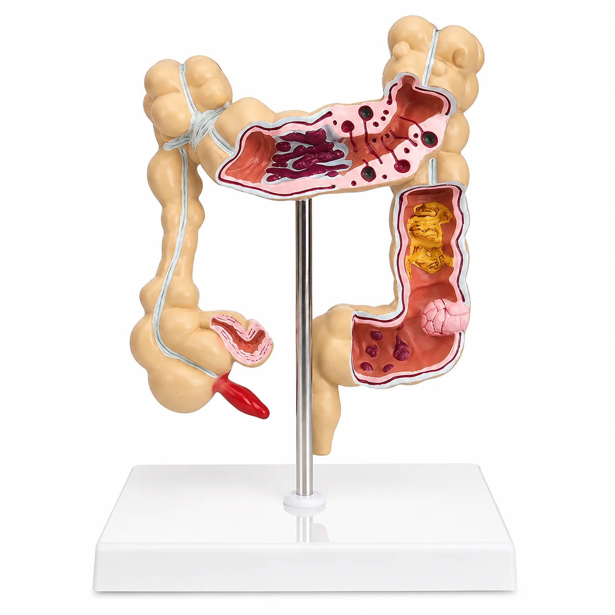 Ein anatomisches Modell des menschlichen Dickdarms auf einem Ständer, das Querschnitte und innere Strukturen zu Lehrzwecken zeigt.