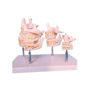 Dental anatomy model showing upper and lower jaws with teeth mounted on metal posts for teaching the bite and tooth arrangement on a white background.